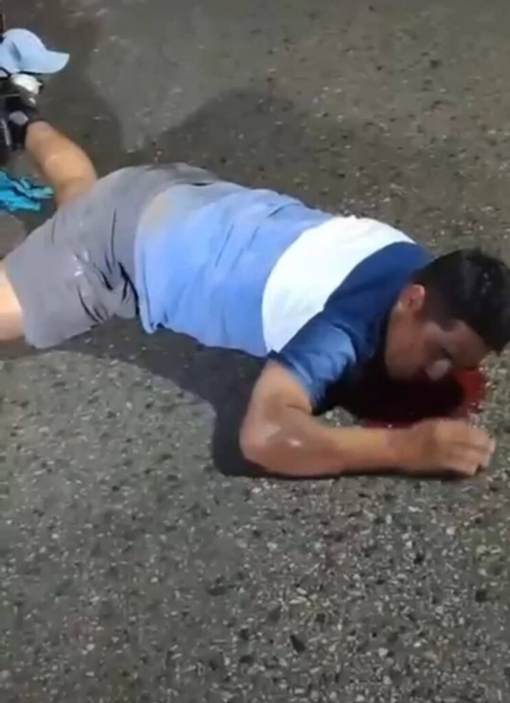 Motociclista resulta lesionado tras derrapar en puente metálico de #Tamazunchale 🏍️💥