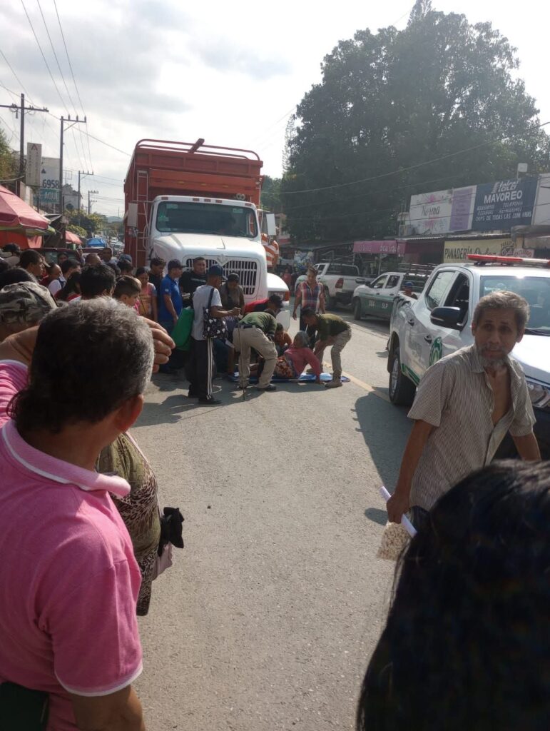 Atropellamiento exhibe caos vial en Matlapa